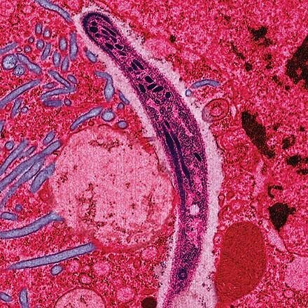 Das Foto zeigt eine von Malaria befallene Zelle in Falschfarbendarstellung