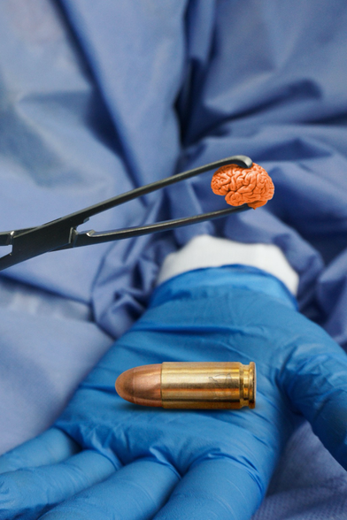 A close-up of a surgeon’s gloved hand holding a bullet and, above that, a pair of surgical forceps holding a tiny orange brain