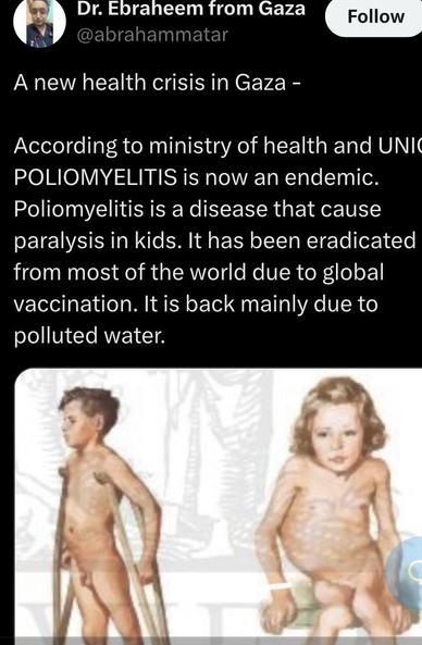 A new health crisis in Gaza - According to ministry of health and UNI( POLIOMYELITIS is now an endemic. Poliomyelitis is a disease that cause paralysis in kids. It has been eradicated from most of the world due to global vaccination. It is back mainly due to polluted water. 
