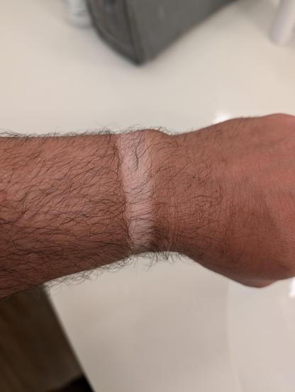 Photo of my left wrist. There is a very pale tan line from where I wear a thin Fitbit style watch. The rest of my skin is brown and deeply tanned.